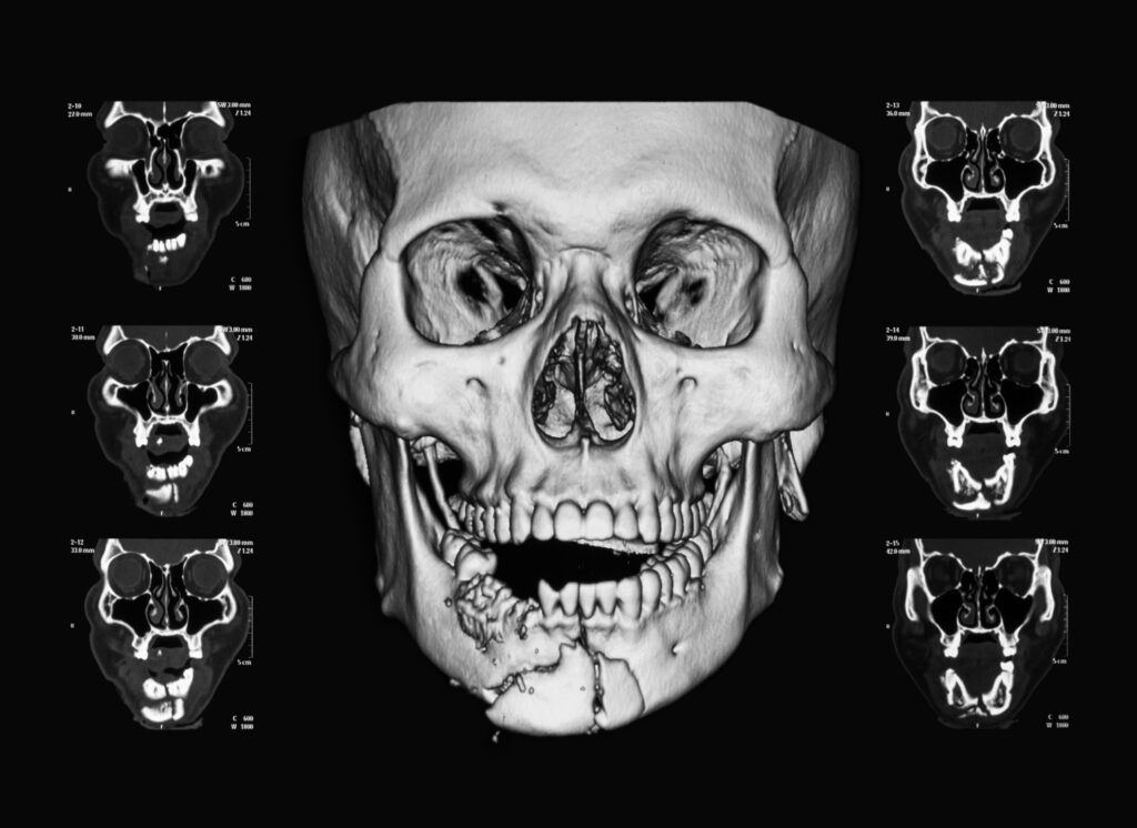 facial trauma dental specialist 