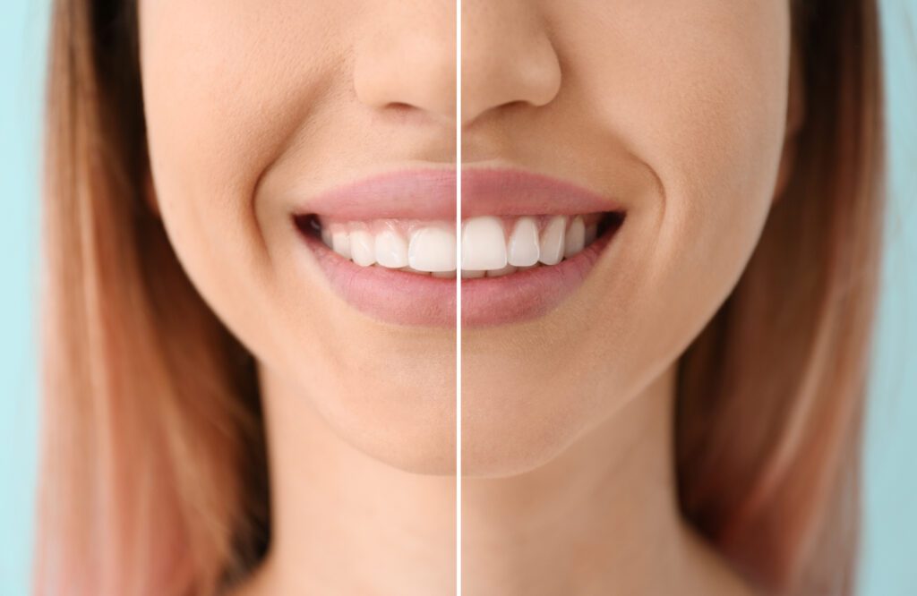 River Forest dentist