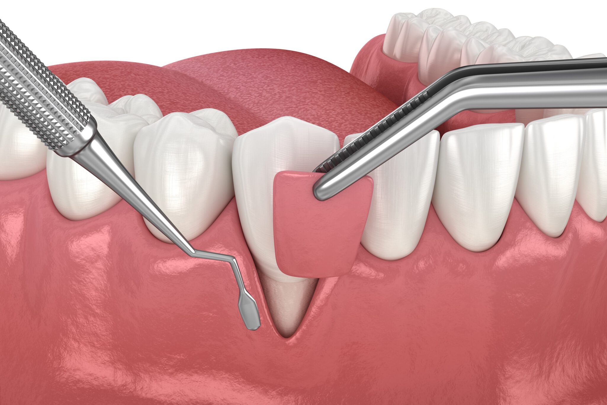 periodontist River Forest