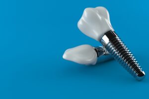 dentist river forest dental implants