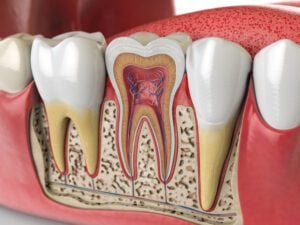 tooth pain Chicago